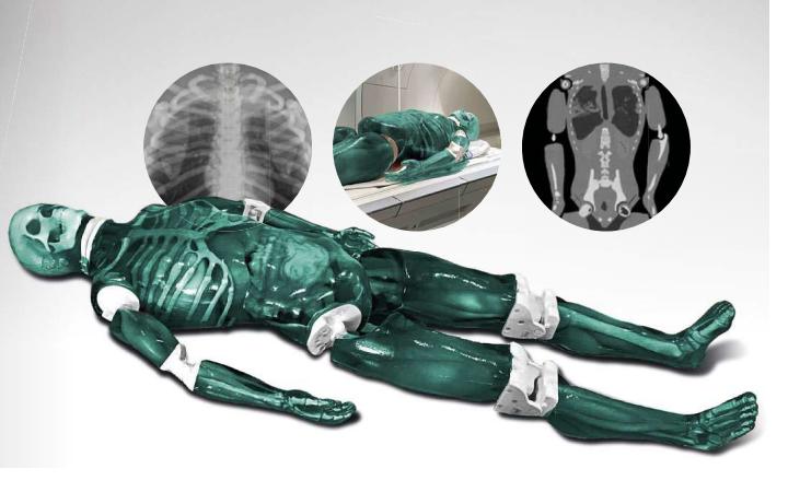 x侀CTMRIһȫ̌Wģwx侀CTһȫ̌Wģw